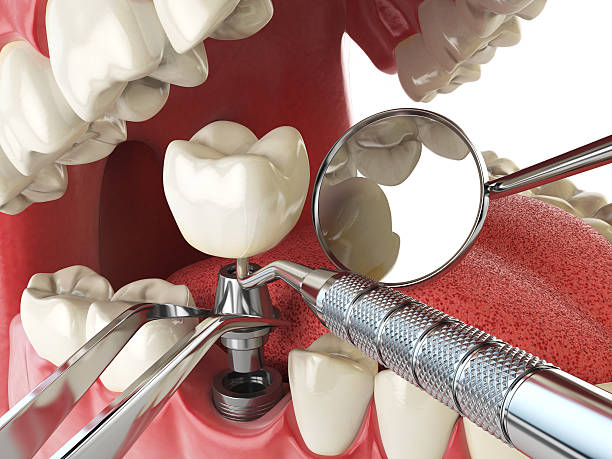 Best Emergency Care for Gum Disease in Catawba, SC